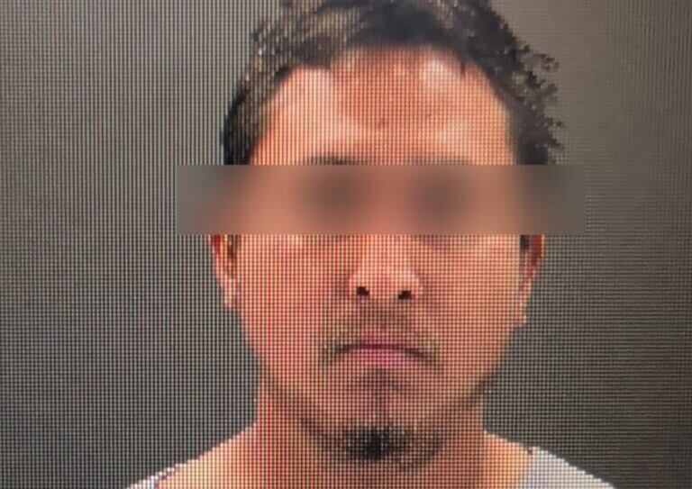 ¡Macheteado! Le causa múltiples heridas de gravedad sobre la Santiago Troncoso
